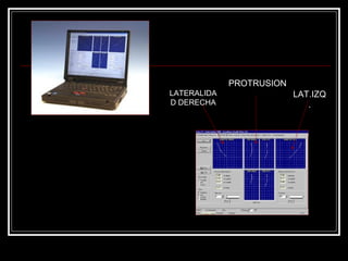 LATERALIDA
D DERECHA
PROTRUSION
LAT.IZQ
.
 