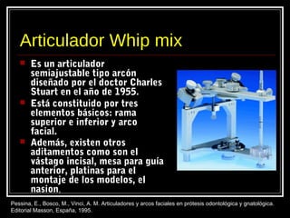 Articulador Whip mix
 Es un articulador
semiajustable tipo arcón
diseñado por el doctor Charles
Stuart en el año de 1955.
 Está constituido por tres
elementos básicos: rama
superior e inferior y arco
facial.
 Además, existen otros
aditamentos como son el
vástago incisal, mesa para guía
anterior, platinas para el
montaje de los modelos, el
nasion,
Pessina, E., Bosco, M., Vinci, A. M. Articuladores y arcos faciales en prótesis odontológica y gnatológica.
Editorial Masson, España, 1995.
 
