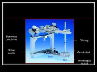 Elementos
condilares
Tornillo guía
incisal
Guía incisal
Platina
inferior
Vástago
 