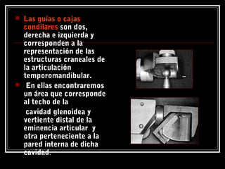  Las guías o cajasLas guías o cajas
condilarescondilares son dos,
derecha e izquierda y
corresponden a la
representación de las
estructuras craneales de
la articulación
temporomandibular.
 En ellas encontraremos
un área que corresponde
al techo de la
cavidad glenoidea y
vertiente distal de la
eminencia articular y
otra perteneciente a la
pared interna de dicha
cavidad.
 