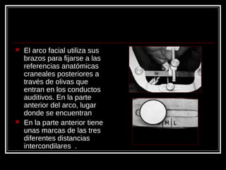  El arco facial utiliza sus
brazos para fijarse a las
referencias anatómicas
craneales posteriores a
través de olivas que
entran en los conductos
auditivos. En la parte
anterior del arco, lugar
donde se encuentran
 En la parte anterior tiene
unas marcas de las tres
diferentes distancias
intercondilares .
 