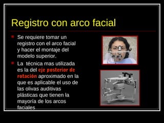 Registro con arco facial
 Se requiere tomar un
registro con el arco facial
y hacer el montaje del
modelo superior.
 La técnica mas utilizada
es la del eje posterior de
rotación aproximado en la
que es aplicable el uso de
las olivas auditivas
plásticas que tienen la
mayoría de los arcos
faciales
 