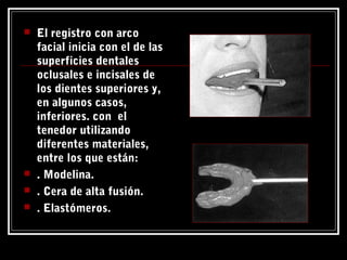  El registro con arco
facial inicia con el de las
superficies dentales
oclusales e incisales de
los dientes superiores y,
en algunos casos,
inferiores. con el
tenedor utilizando
diferentes materiales,
entre los que están:
 . Modelina.
 . Cera de alta fusión.
 . Elastómeros.
 