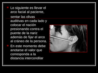  Lo siguiente es llevar el
arco facial al paciente,
sentar las olivas
auditivas en cada lado y
colocar el nación
presionando contra el
puente de la nariz
además de fijar el arco
al cráneo de la persona.
 En este momento debe
anotarse el valor que
corresponda a la
distancia intercondilar
 