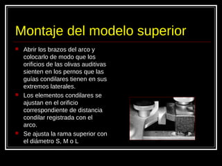 Montaje del modelo superior
 Abrir los brazos del arco y
colocarlo de modo que los
orificios de las olivas auditivas
sienten en los pernos que las
guías condilares tienen en sus
extremos laterales.
 Los elementos condilares se
ajustan en el orificio
correspondiente de distancia
condilar registrada con el
arco.
 Se ajusta la rama superior con
el diámetro S, M o L
 