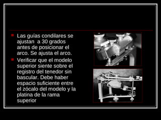  Las guías condilares se
ajustan a 30 grados
antes de posicionar el
arco. Se ajusta el arco.
 Verificar que el modelo
superior siente sobre el
registro del tenedor sin
bascular. Debe haber
espacio suficiente entre
el zócalo del modelo y la
platina de la rama
superior
 