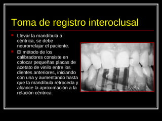 Toma de registro interoclusal
 Llevar la mandíbula a
céntrica, se debe
neurorrelajar el paciente.
 El método de los
calibradores consiste en
colocar pequeñas placas de
acetato de vinilo entre los
dientes anteriores, iniciando
con una y aumentando hasta
que la mandíbula retroceda y
alcance la aproximación a la
relación céntrica.
 
