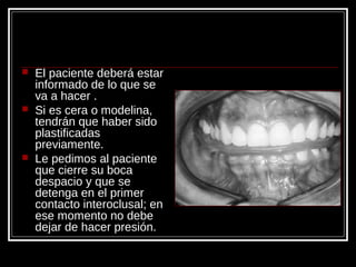  El paciente deberá estar
informado de lo que se
va a hacer .
 Si es cera o modelina,
tendrán que haber sido
plastificadas
previamente.
 Le pedimos al paciente
que cierre su boca
despacio y que se
detenga en el primer
contacto interoclusal; en
ese momento no debe
dejar de hacer presión.
 