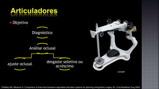 Objetivo
Diagnóstico
ajuste oclusal
desgaste seletivo ou
acréscimo
Análise oclusal
O’Malley AM, Milosevic A. Comparison of three face bow/semi-adjustable articulator systems for planning orthognathic surgery. Br J Oral Maxillofac Surg 2000
AOCMF
 