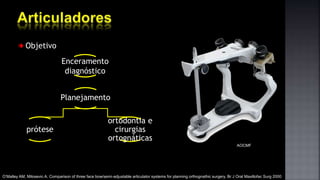 Objetivo
Enceramento
diagnóstico
prótese
ortodontia e
cirurgias
ortognáticas
Planejamento
AOCMF
O’Malley AM, Milosevic A. Comparison of three face bow/semi-adjustable articulator systems for planning orthognathic surgery. Br J Oral Maxillofac Surg 2000
 