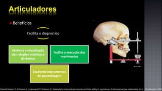 Benefícios
Facilita o diagnostico
Melhora a visualização
das relações estáticas e
dinâmicas
Excelente instrumentos
de aprendizagem
Facilita a execução dos
movimentos
AOCMF
Ockert-Eriksson G, Eriksson A, Lockowandt P, Eriksson O. Materials for interocclusal records and their ability to reproduce a 3-dimensional jaw relationship. Int J Prosthodont. 2000
 