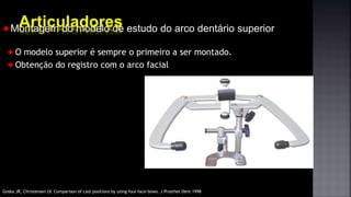 Montagem do modelo de estudo do arco dentário superior
O modelo superior é sempre o primeiro a ser montado.
Obtenção do registro com o arco facial
Goska JR, Christensen LV. Comparison of cast positions by using four face-bows. J Prosthet Dent 1998
 