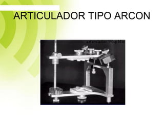 ARTICULADOR TIPO ARCON
 