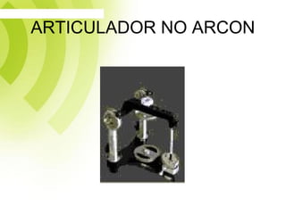 ARTICULADOR NO ARCON
 