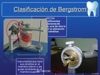 Clasificación de Bergstrom ARCON NO ARCON 
