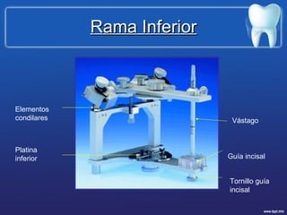 Rama Inferior Elementos condilares Tornillo guía incisal Guía incisal Platina inferior Vástago 