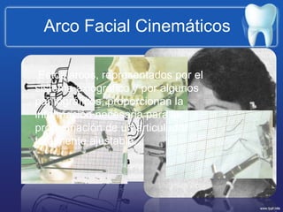 Arco Facial Cinemáticos  Estos arcos, representados por el sistema axiográfico y por algunos pantográficos, proporcionan la información necesaria para la programación de un articulador totalmente ajustable. 
