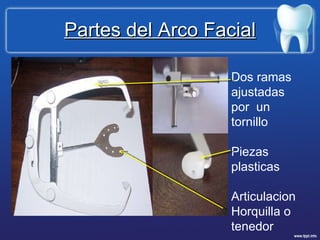 Partes del Arco Facial Dos ramas ajustadas por  un tornillo Piezas plasticas Articulacion Horquilla o tenedor 