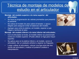 Técnica de montaje de modelos de estudio en el articulador Montaje  del modelo superior a la rama superior  del articulador.  Se hace la programación de valores promedios que presentó el paciente.  Se coloca el modelo de yeso sobre el tenedor, o apoyo elegido para asegurar evitar el balanceo del modelo. Agregar yeso entre la platina y el modelo, esperar a que frague y acinturar el yeso . Montaje  del modelo inferior a la rama inferior del articulador.  Con el articulador al revés, el modelo inferior es posicionado contra en modelo superior. (Puede utilizar un liga para mayor soporte) Se aplica yeso en la platina inferior y al modelo, cerrar el articulador, dar un acabado artístico y esperar su fraguado. Luego voltear el articulador, colocar una liga entre las dos ramas del articulador y realizar el posterior análisis e interpretación.  