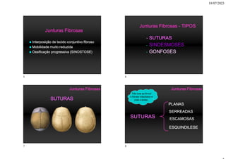 18/07/2023
Junturas Fibrosas
 Interposição de tecido conjuntivo fibroso
 Mobilidade muito reduzida
 Ossificação progressiva (SINOSTOSE)
Junturas Fibrosas - TIPOS
- SUTURAS
- SINDESMOSES
- GONFOSES
Junturas Fibrosas
SUTURAS
PLANAS
ESCAMOSAS
SERREADAS
ESQUINDILESE
Junturas Fibrosas
SUTURAS
Não tem no livro!
A forma relaciona-se
com o nome.
5 6
7 8
 