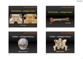 18/07/2023
Sincondrose – cartilagem hialina
Inter-óssea
Junturas Cartilaginosas
Sincondrose – cartilagem hialina
Intra-óssea
Junturas Cartilaginosas
Sobotta
Sínfise – cartilagem fibrosa
Sínfise mentoniana
Junturas Cartilaginosas
Sobotta
Sínfise – cartilagem fibrosa
Sínfise púbica
Junturas Cartilaginosas
Sobotta
17 18
19 20
 