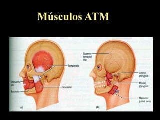 Músculos ATM
 