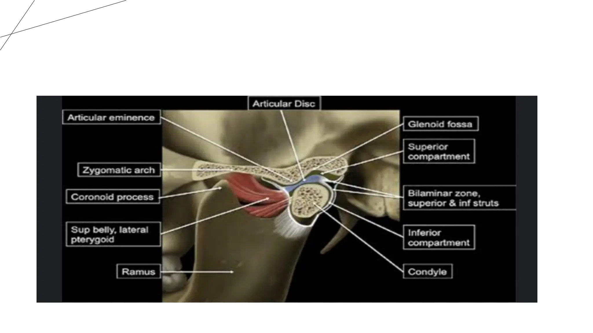 ARTICULAR DISC OF TEMPOROMANDIBULAR JOINT | PDF