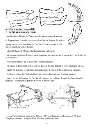 6.1.3-le transfert du modèle
> : se fait en plusieurs étapes
- localisation arbitraire de l’axe charnière et marquage de cet axe
et du point sous orbitaire, au crayon d’aniline sur la peau du patient.
- préparation de la fourchette de l’arc facial en mettant de la cire
moyco (hard) de part et d’autre.
 -chauffer la cire à 52° et porter la fourchette en bouche
  -demander au patient de serrer pour imprimer les encoches de la maquette > sur la cire de
la fourchette.
 -vérifier la stabilité de la maquette > sur la fourchette.
 -la tige de la fourchette doit se trouver du coté droit du patient et perpendiculaire à l’arc.
 -régler les embouts condyliens, par rapport aux 2 points de l’axe charnière marqués.
 -Mettre la pointe de l’index orbitaire en contact du point sous orbitaire marqué.
 -serrer les vis de blocage de l’arc facial. -écarter les embouts des points d’axe charnière
marqués. -demander au patient d’ouvrir, et retirer l’arc.




 -régler l’articulateur à sa position de base : 40° pour la pente condylienne, et 20° pour
l’angle de Bennett. La tige incisive bloquée en dessous de 0.

                                                10
 