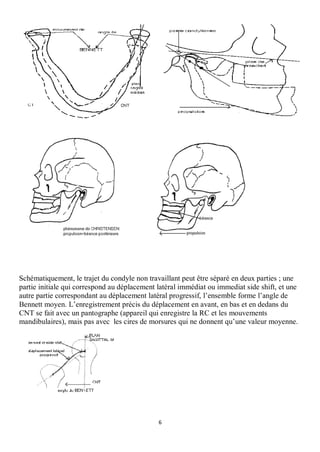 Schématiquement, le trajet du condyle non travaillant peut être séparé en deux parties ; une
partie initiale qui correspond au déplacement latéral immédiat ou immediat side shift, et une
autre partie correspondant au déplacement latéral progressif, l’ensemble forme l’angle de
Bennett moyen. L’enregistrement précis du déplacement en avant, en bas et en dedans du
CNT se fait avec un pantographe (appareil qui enregistre la RC et les mouvements
mandibulaires), mais pas avec les cires de morsures qui ne donnent qu’une valeur moyenne.




                                              6
 