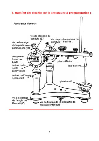 6. transfert des modèles sur le dentatus et sa programmation :




                             8
 