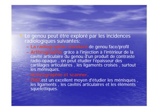 • Le genou peut être exploré par les incidences
  radiologiques suivantes:
  – La radiographie standard de genou face/profil
  – Arthrographie grâce à l'injection à l'intérieur de la
    cavité articulaire du genou d'un produit de contraste
    radio-opaque , on peut étudier l’épaisseur des
    cartilages articulaires , les ligaments croisés , surtout
    les ménisques.
  – Arthrographie et scanner.
  – IRM.est un excellent moyen d'étudier les ménisques ,
    les ligaments , les cavités articulaires et les éléments
    squelettiques.
 