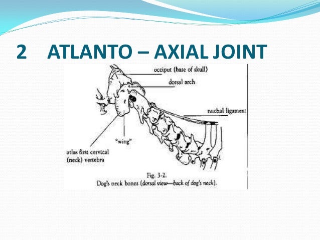 Articulations Of The vertebral column and ribs articulations-of-the-vertebral-column-and-ribs