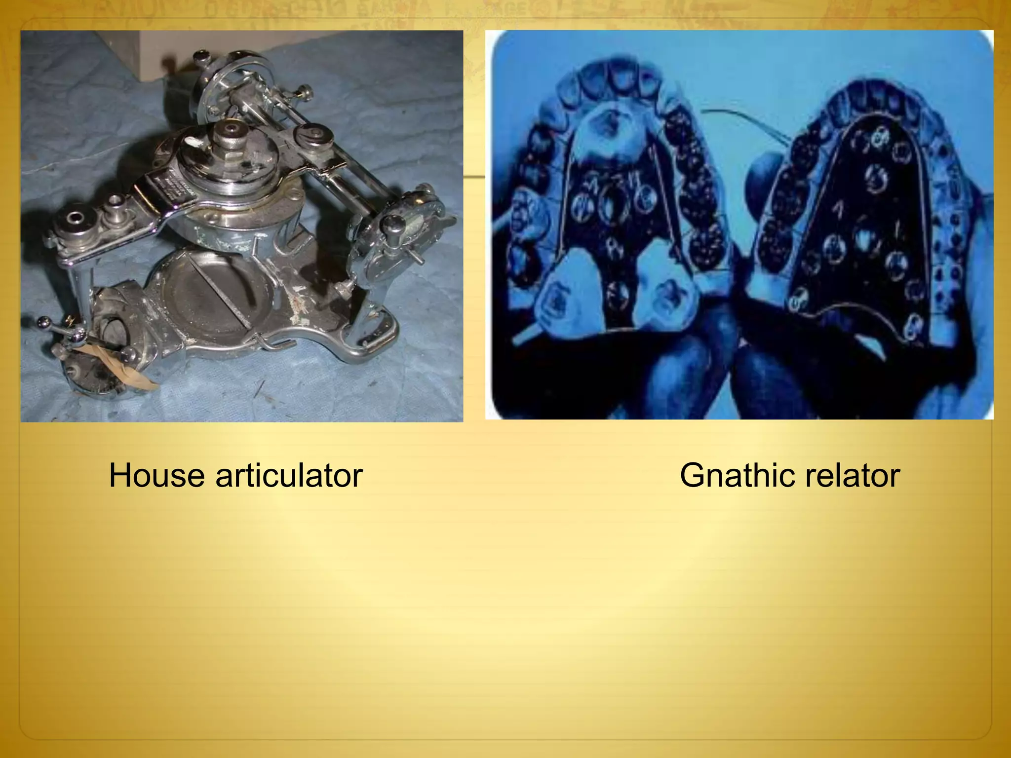House articulator Gnathic relator
 