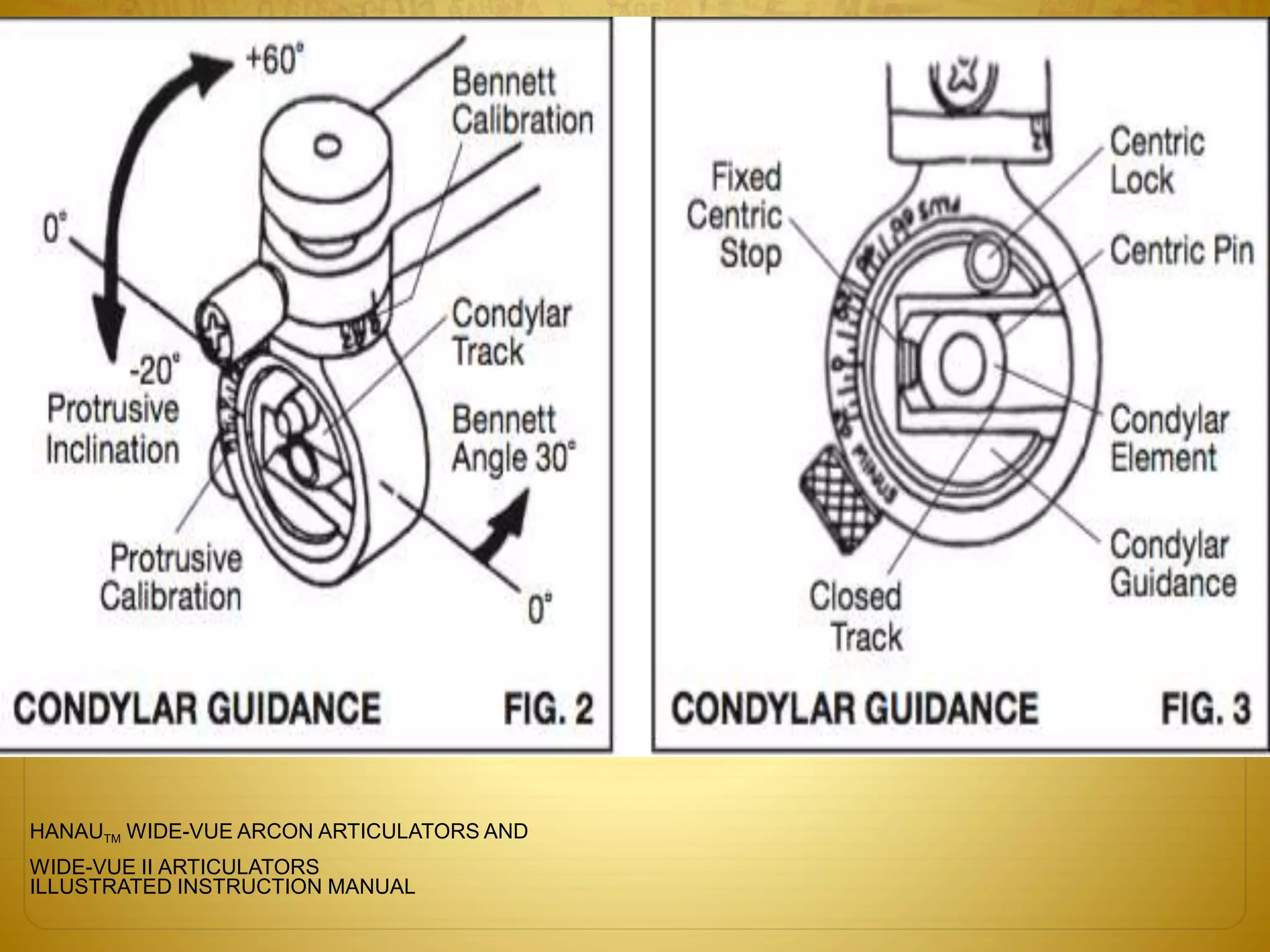 HANAUTM WIDE-VUE ARCON ARTICULATORS AND
WIDE-VUE II ARTICULATORS
ILLUSTRATED INSTRUCTION MANUAL
 
