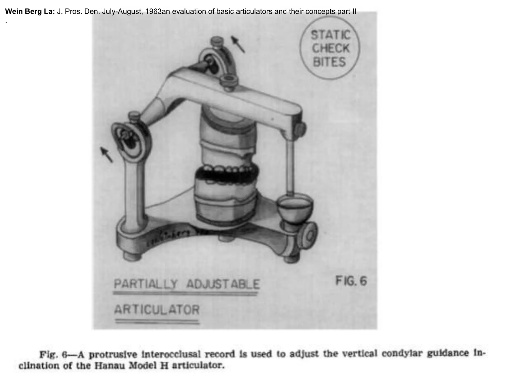 Wein Berg La: J. Pros. Den. July-August, 1963an evaluation of basic articulators and their concepts part II
.
 