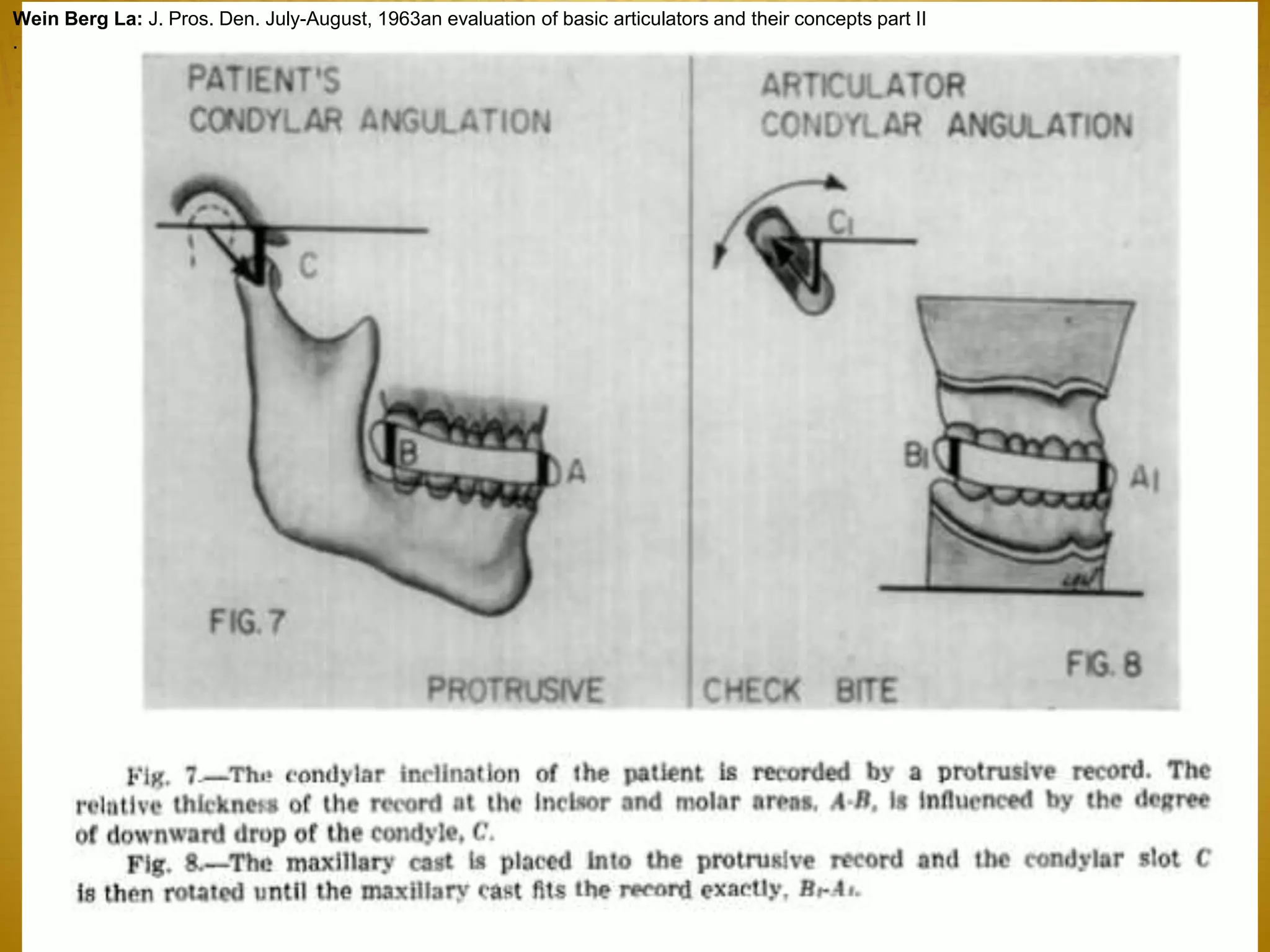 Wein Berg La: J. Pros. Den. July-August, 1963an evaluation of basic articulators and their concepts part II
.
 