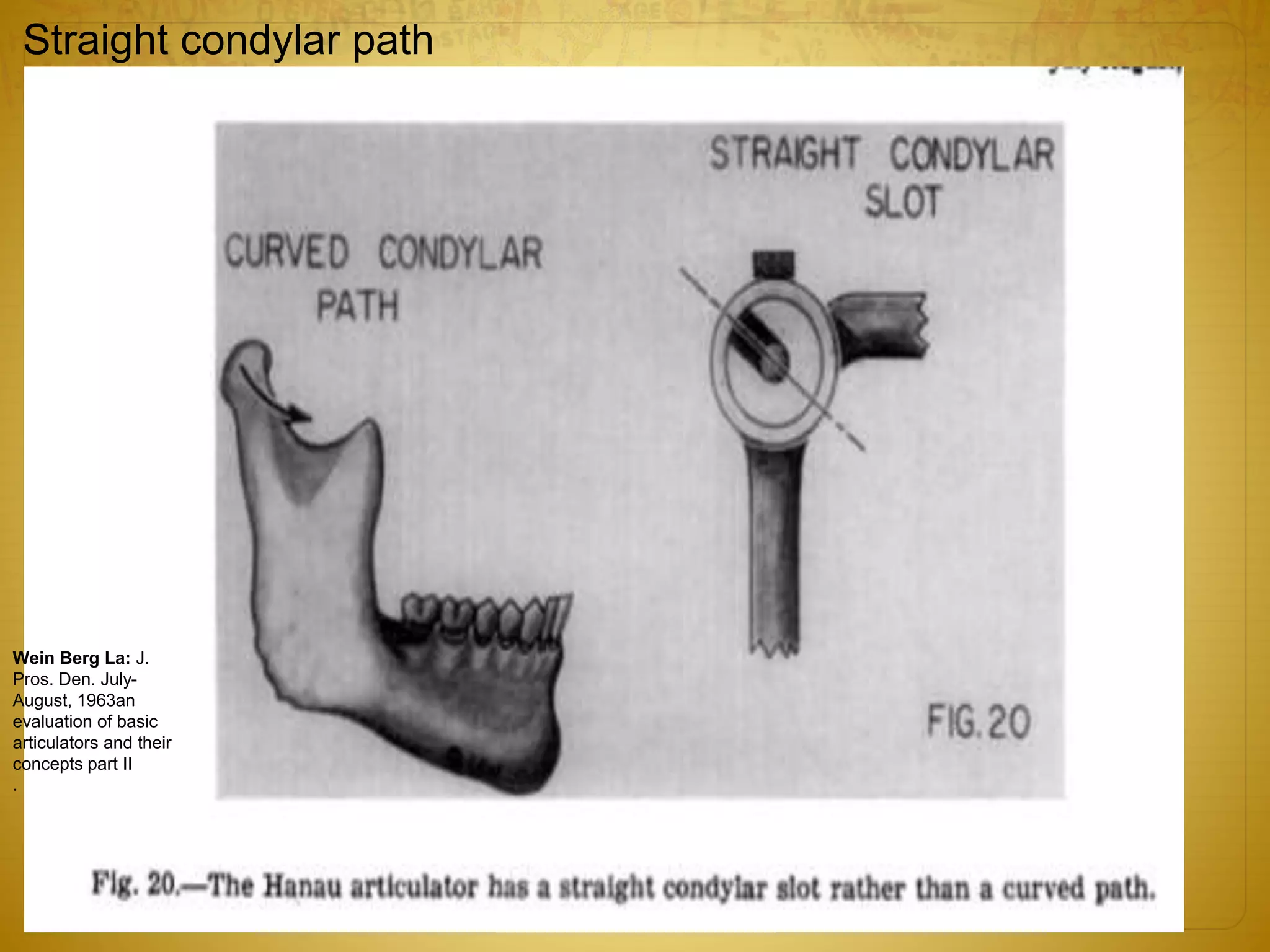 Straight condylar path
Wein Berg La: J.
Pros. Den. July-
August, 1963an
evaluation of basic
articulators and their
concepts part II
.
 