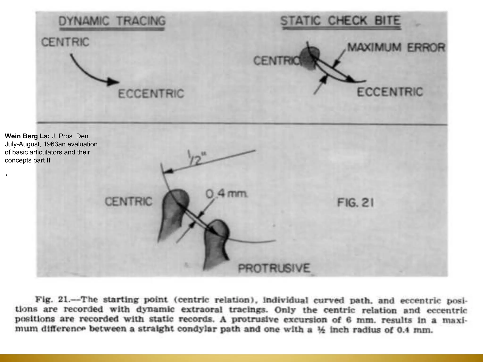 Wein Berg La: J. Pros. Den.
July-August, 1963an evaluation
of basic articulators and their
concepts part II
.
 