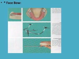 • * Face Bow:
 