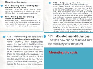 Mounting the casts
 