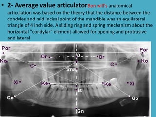 • 2- Average value articulatorBon will's anatomical
  articulation was based on the theory that the distance between the
  condyles and mid incisal point of the mandible was an equilateral
  triangle of 4 inch side. A sliding ring and spring mechanism about the
  horizontal "condylar" element allowed for opening and protrusive
  and lateral
 