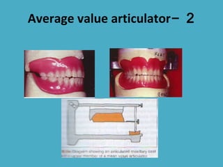  
Average value articulator- 2
 