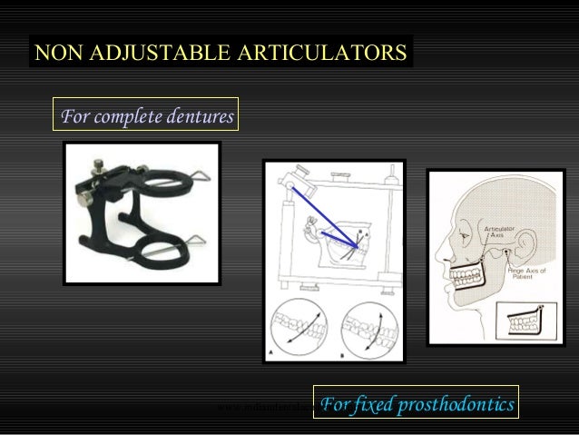 Straight Line Articulator : Articulators cosmetic dentistry training