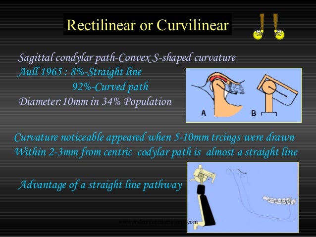 Straight Line Articulator : Articulators cosmetic dentistry training