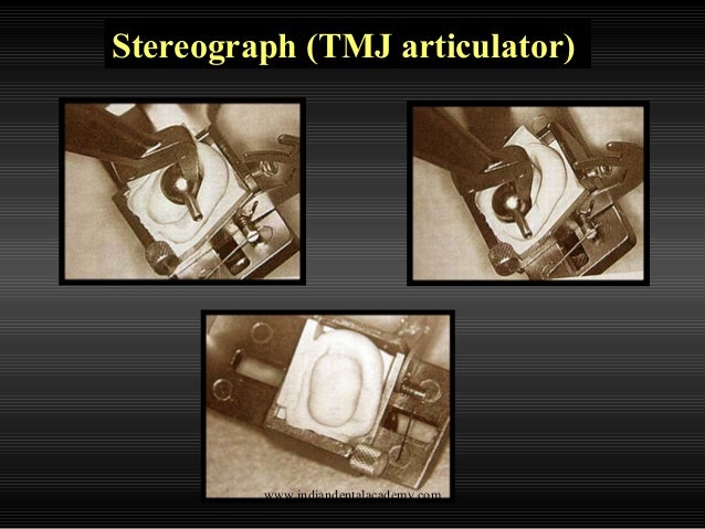 Straight Line Articulator : Articulators cosmetic dentistry training