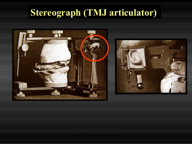 Straight Line Articulator : Articulators cosmetic dentistry training