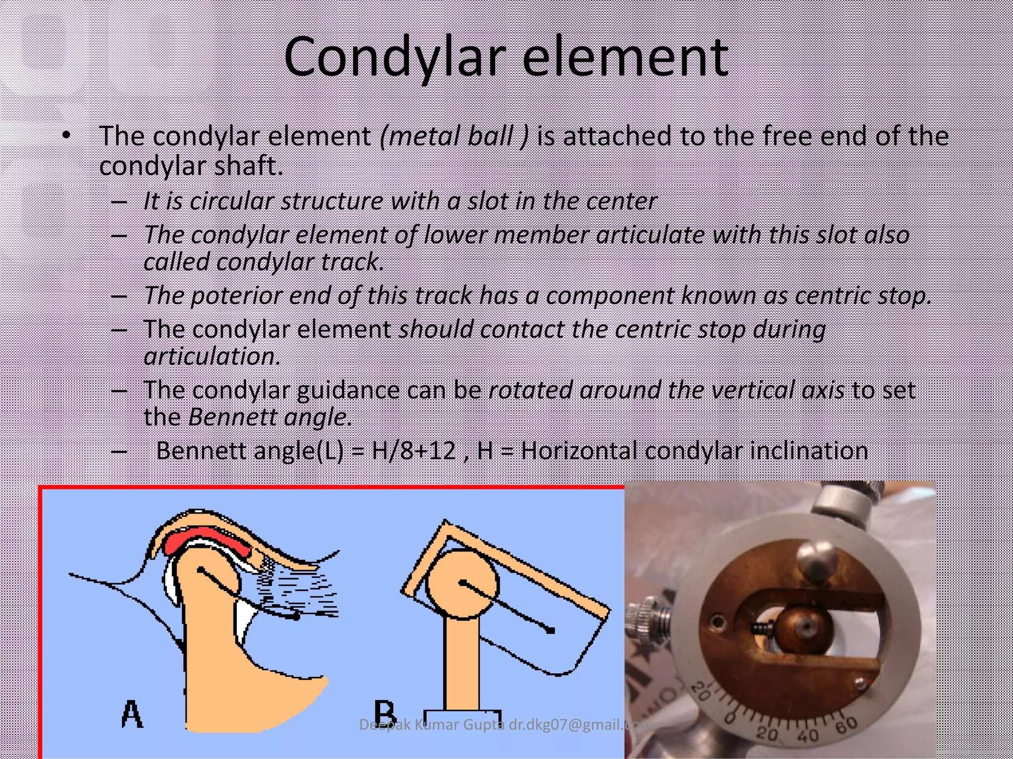 Condylar element 
• The condylar element (metal ball ) is attached to the free end of the 
condylar shaft. 
– It is circular structure with a slot in the center 
– The condylar element of lower member articulate with this slot also 
called condylar track. 
– The poterior end of this track has a component known as centric stop. 
– The condylar element should contact the centric stop during 
articulation. 
– The condylar gguuiiddaannccee ccaann bbee rroottaatteedd aarroouunndd tthhee vveerrttiiccaall aaxxiiss ttoo sseett 
the Bennett angle. 
– Bennett angle(L) = H/8+12 , H = Horizontal condylar inclination 
Deepak Kumar Gupta dr.dkg07@gmail.com 
 
