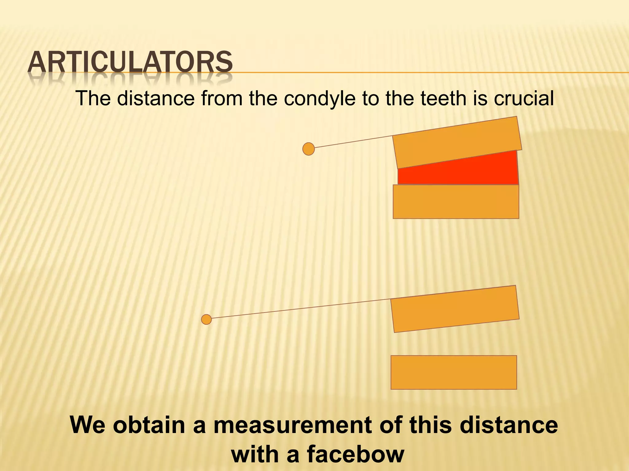 ARTICULATORS
The distance from the condyle to the teeth is crucial
We obtain a measurement of this distance
with a facebow
 