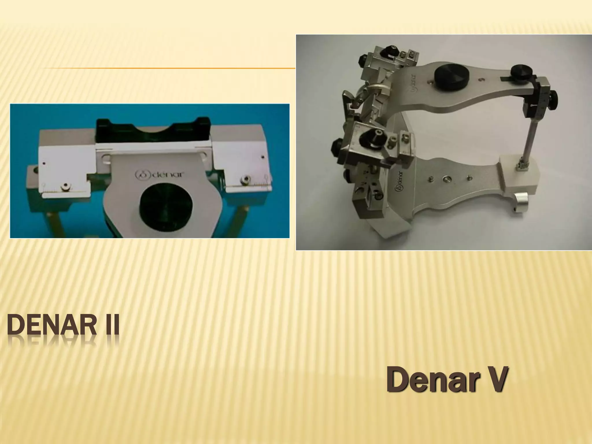 DENAR II
Denar V
 