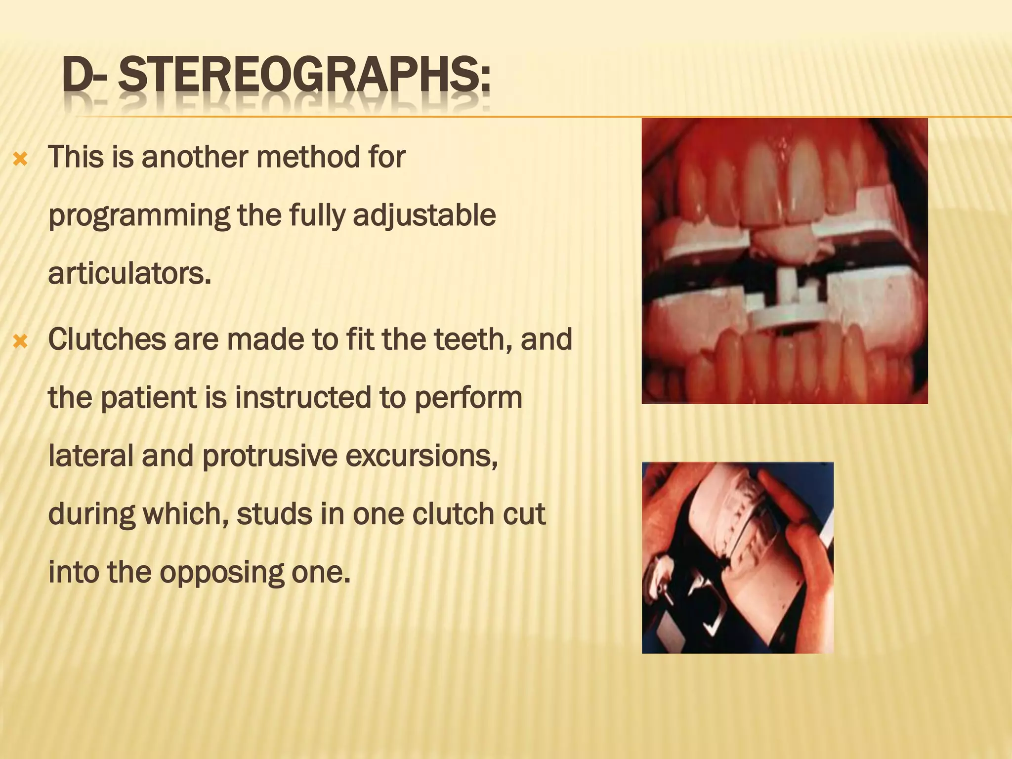 D- STEREOGRAPHS:
 This is another method for
programming the fully adjustable
articulators.
 Clutches are made to fit the teeth, and
the patient is instructed to perform
lateral and protrusive excursions,
during which, studs in one clutch cut
into the opposing one.
 